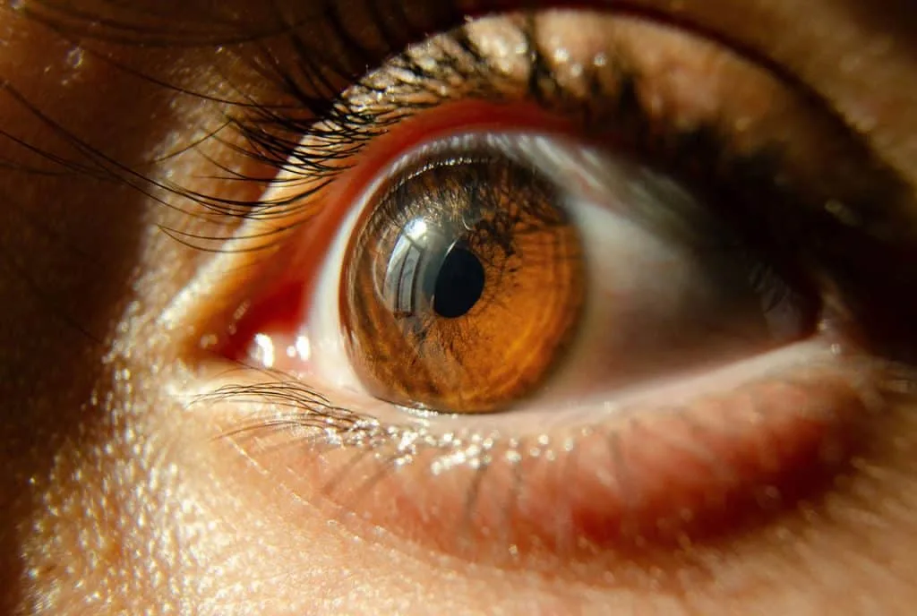 7 ventajas de usar lentillas en tu día a día